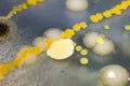 Colonies of different bacteria and mold fungi Royalty Free Stock Photo