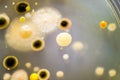 Colonies of different bacteria and mold fungi Royalty Free Stock Photo