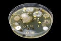 Colonies of different bacteria and molds