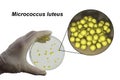 Colonies of Micrococcus luteus bacteria on agar plate