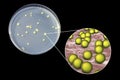 Colonies of Micrococcus luteus bacteria on agar plate