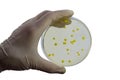 Colonies of different bacteria and mold fungi grown on Petri dish with nutrient agar