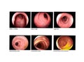 Colonoscopy Anal canal,rectum,sigmoid,descending colon,transverse colon.