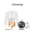 Colonoscopy in the colon. Silhouette of the man with the colon and close-up of endoscope