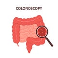 Colonoscopy concept. Intestine exam and treatment. Colon polypectomy procedure. Prevention of cancer. Vector