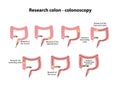 Colonoscopy. Diagnosis of the colon. Infographics. Vector illustration on background