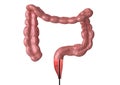 Colonoscopy - is the endoscopic examination of the large intestine and rectum that helps in the discovery of bowel cancer