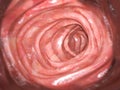 Colonoscopy. Inside of healthy colon, large intestine.Human digestive system Royalty Free Stock Photo