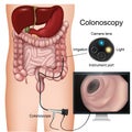 Colonoscopy procedure labeled 3d  diagram on white background Royalty Free Stock Photo