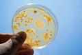Colony of bacteria in culture medium plate Royalty Free Stock Photo