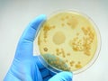 Colony of bacteria in culture medium plate Royalty Free Stock Photo