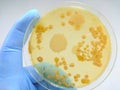 Colony of bacteria in culture medium plate Royalty Free Stock Photo