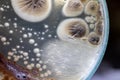 Colony of Characteristics of Fungus Mold in culture medium plate from laboratory microbiology.