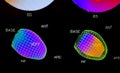 Color adenosine cardiac stress test images on black background