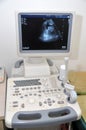 Color Doppler ultrasound