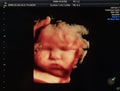 Color ultrasound image, fetus 20 weeks gestation. The baby face in the womb. blur and selective focus Royalty Free Stock Photo