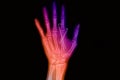 Colorful wrist and hand x-rays image Royalty Free Stock Photo