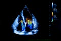 Colourful image of homan heart ultrasound monitor