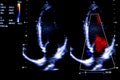 Colourful image of homan heart ultrasound monitor