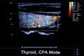 Colourful image of modern ultrasound monitor