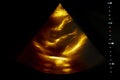 Colourful image of pregnancy ultrasound monitor