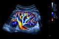 Colourful image of modern ultrasound monitor