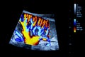 Colourful image of modern ultrasound monitor