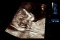 Colourful image of pregnancy ultrasound monitor