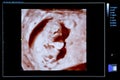 Colourful image of pregnancy ultrasound monitor