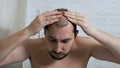 Combating hair loss in men. Injections to the head. Treatment for male pattern baldness. Early hair loss. A man uses a