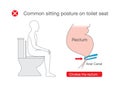 Common posture while sitting on toilet make rectum discomfort.