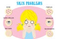 6 Common Skin Problems on Face Royalty Free Stock Photo