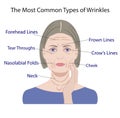 Common Types of Facial Wrinkles. cosmetic surgery. woman facial treatment Royalty Free Stock Photo