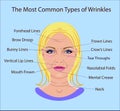 Common Types of Facial Wrinkles. cosmetic surgery. woman facial treatment isolated