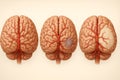 Comparative 3D render of three brains: normal brain with clear arteries, second with blocked artery and small ischemic zone, third Royalty Free Stock Photo