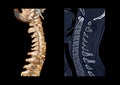 Compare of CT C-Spine or Cervical spine 3D Rendering image and sagittal