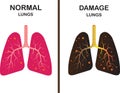 Compare vector illustration of normal and damaged lung damage isolated Royalty Free Stock Photo