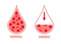 Comparing two drops of blood normal and anemic blood cells. Low hemoglobin. Isolated image on white background