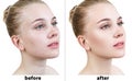 Portrait of woman before and after retouch.