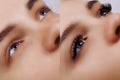 Eyelash Extension. Comparison of female eyes before and after.