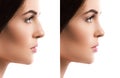 Comparison female face after rhinoplasty on white background