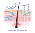 Comparison of healthy and damaged skin barrier vector on white background.