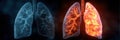 Comparison of Healthy Lung and Cancerous Lung Showing Visual Differences in Structure and Coloration Royalty Free Stock Photo