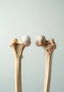 Comparison of healthy and osteoporotic bone structure with hip joint model Royalty Free Stock Photo