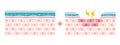 Comparison illustration between normal and dry eye. Cross section of eye surface. no text Royalty Free Stock Photo