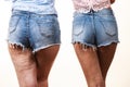 Comparison of legs with and without cellulite Royalty Free Stock Photo