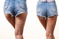 Comparison of legs with and without cellulite Royalty Free Stock Photo