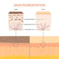 Skin tone pigmentation mechanism infographic medical diagram