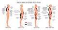 Comparison of muscle imbalance in various postural disorders. Kyphotic, lordotic, flat back posture infographics