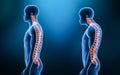 Comparison between normal curvature of the spine and kyphosis with male model from lateral view 3D rendering illustration. Human Royalty Free Stock Photo